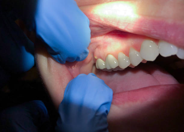 Trusted NC Emergency Dental Service Experts
